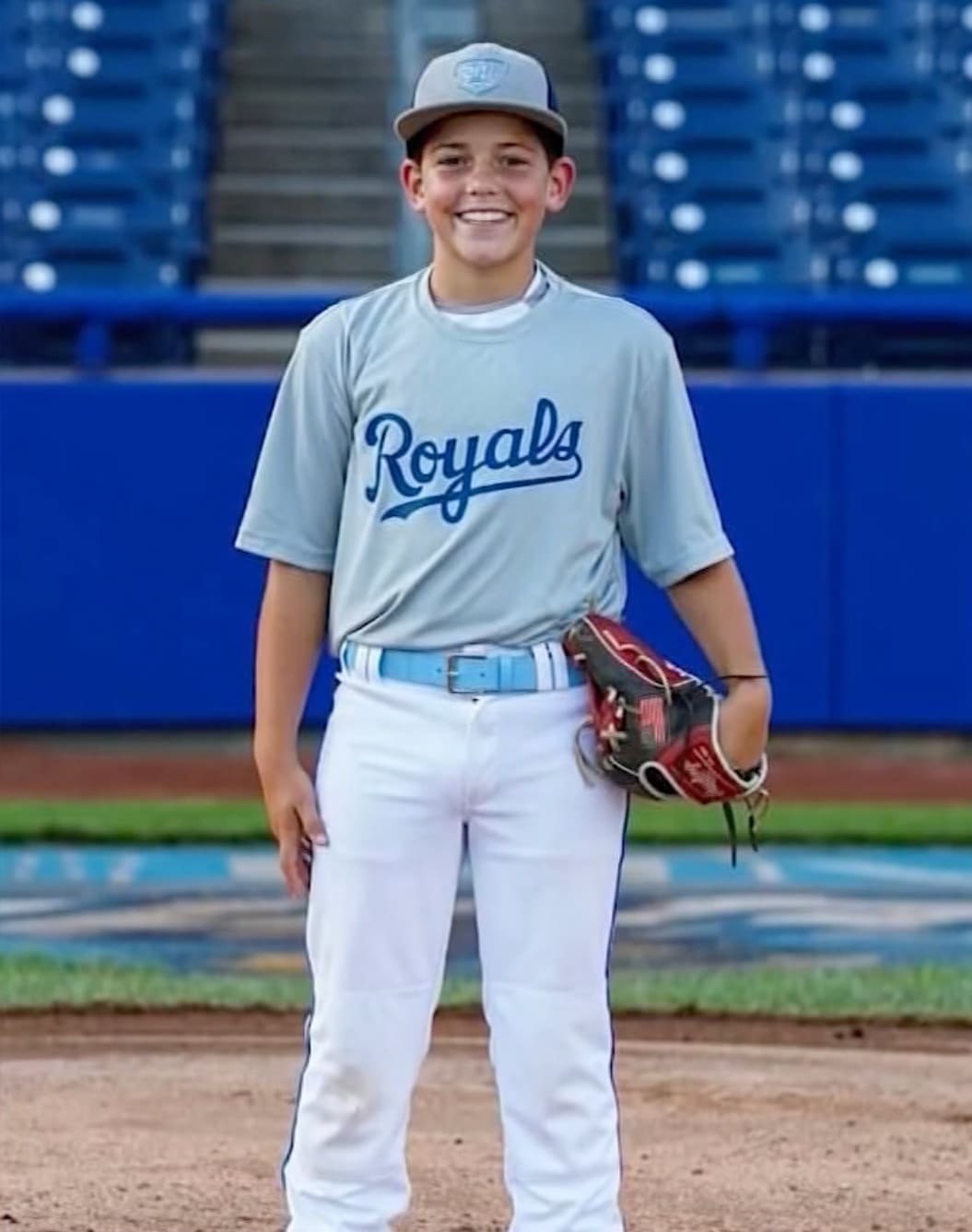 12-year-old New Jersey boy in critical condition after baseball strikes  head in pregame warmups